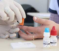 Procura por testes de HIV diminui durante a pandemia, mas casos da doença se mantém