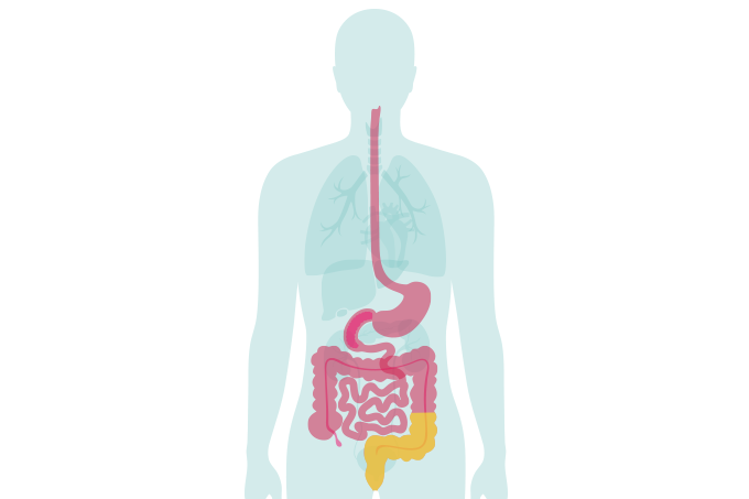 Novos medicamentos são regulamentados para tratamento de doenças inflamatórias intestinais